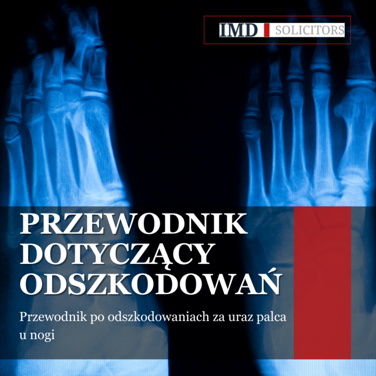 Przewodnik po roszczeniach za urazy palców stóp, omówienie kwot odszkodowań, kluczowych czynników oraz praktycznych kwestii. Dowiedz się, jak IMD Solicitors LLP wspiera poszkodowanych.